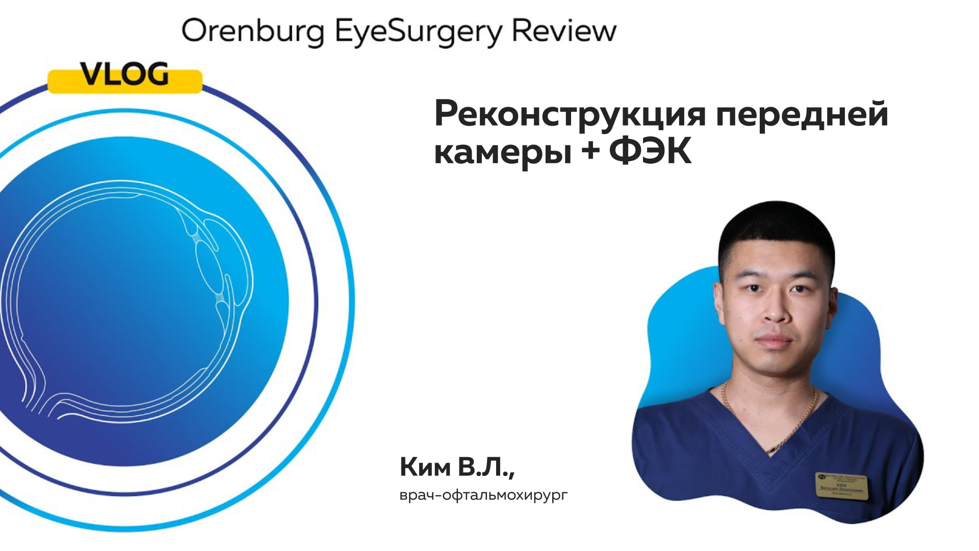 Реконструкция передней камеры + ФЭК