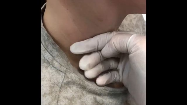 Алопеция и анемия у ребёнка 12 лет, началась с 5 лет причина, что делать. смотреть онлайн