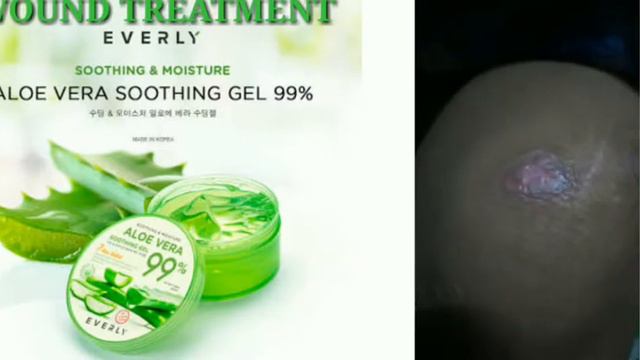 ALOE VERA SOOTHING GEL 99%