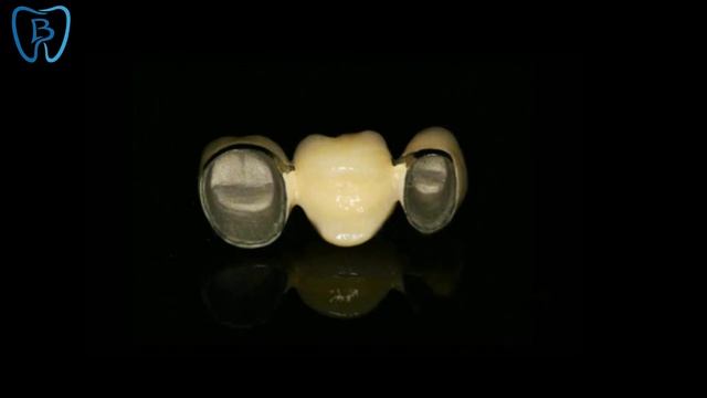 High Stability PFM Zirconia Crown Tooth Stain Resistant For Research смотреть онлайн