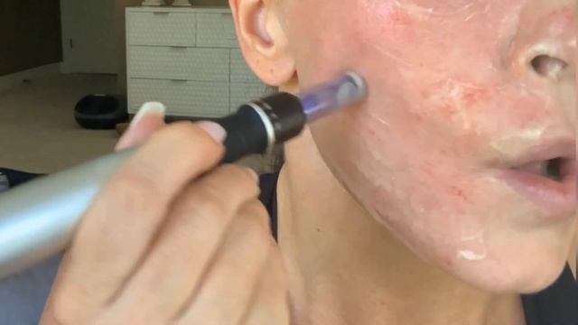 HOW TO GET RID OF DARK CIRCLES UNDER THE EYES #undereyewrinkles смотреть онлайн