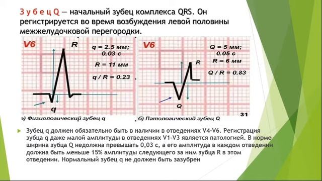 Электрокардиография смотреть онлайн