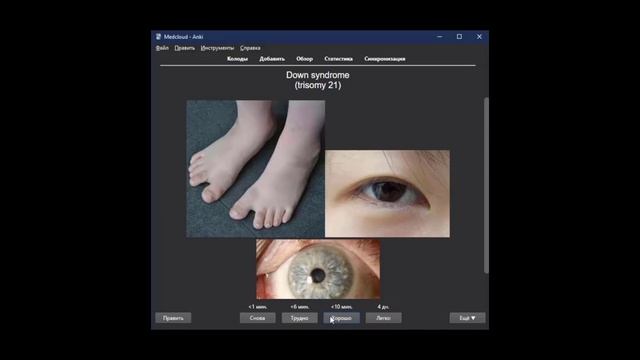 Что такое ANKI и как с ним работать? Полная инструкция