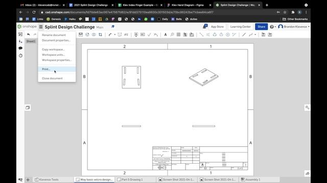 Splint Design Onshape Design смотреть онлайн