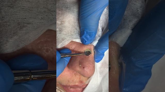 Выдавливание