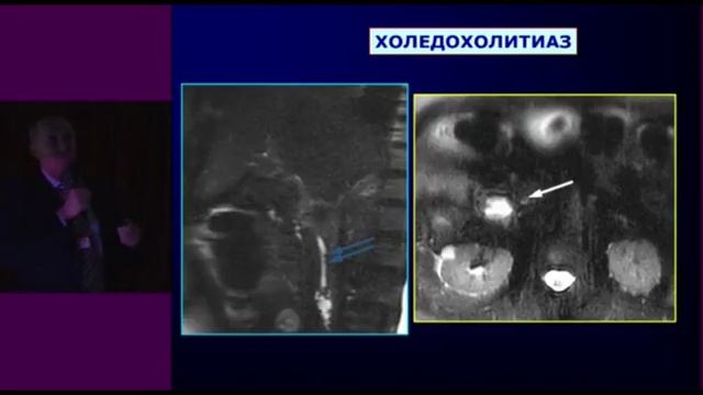 ДИАГНОСТИКА ЗАБОЛЕВАНИЙ ГЕПАТОБИЛИАРНОЙ ЗОНЫ.  ШКОЛА HPB ХИРУРГИИ. КБ № 122 – 2014 г.