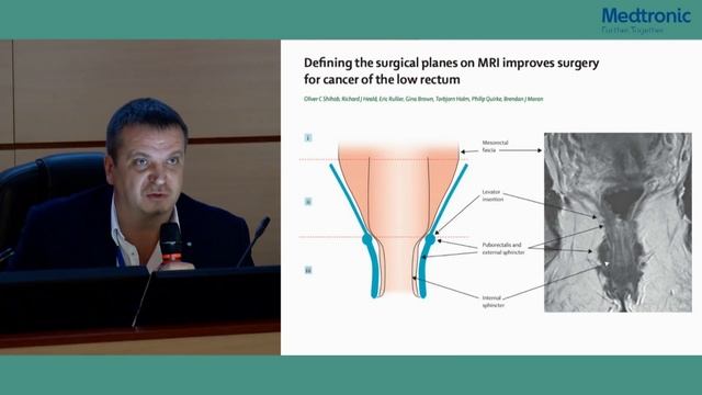 НМИЦ Блохина 02.02.2018. А.Карачун. Интерсфинктерная резекция резекция - против смотреть онлайн