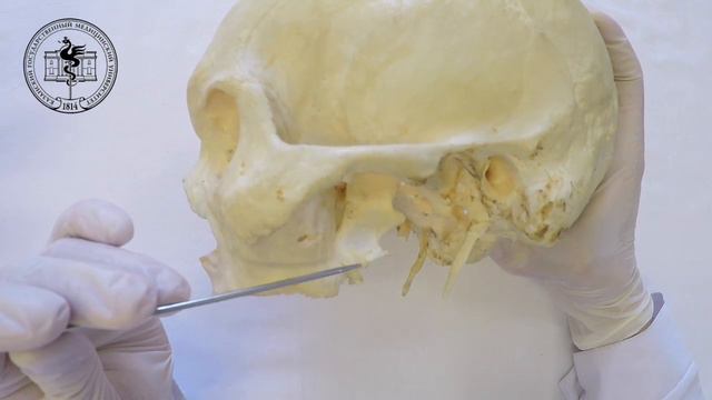 Fossa infratemporalis смотреть онлайн