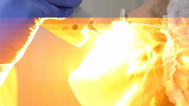 КУПЕРОЗ? РОЗАЦЕЯ? СОСУДЫ НА ЛИЦЕ? ПРОЦЕДУРА VBEAM ОСТАВЛЯЕТ ИХ В ПРОШЛОМ! Удаление лазером. смотреть онлайн