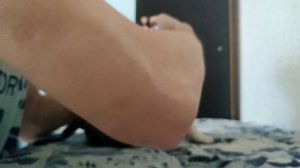 Купирование ушей щенку Стаффорда/Смотрим на результат