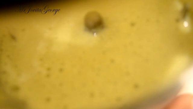 How To Stop Hair Loss and Treat Dandruff At Home Treatment and make hair grow long really fast смотреть онлайн
