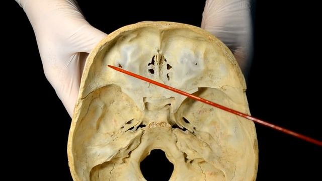 Передняя черепная ямка