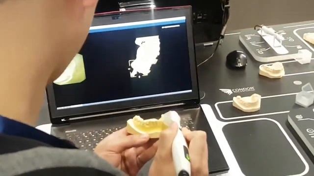 Condor Scan - The Revolutionary Intraoral Color Scanner смотреть онлайн