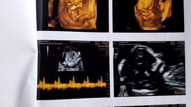 My baby boy all scan reports !! 100% true and real experience !! смотреть онлайн
