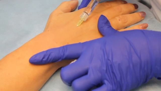 Биоревитализация кожи кистей рук смотреть онлайн