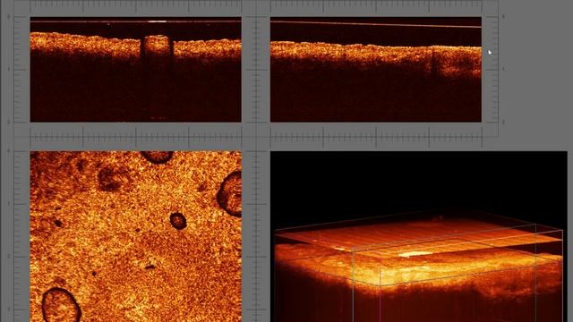 Снимок участка кожи полученный при помощи Системы ОКТ. смотреть онлайн