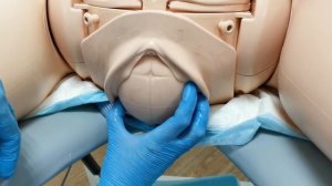 Биомеханизм родов при заднем виде затылочного предлежания.mp4