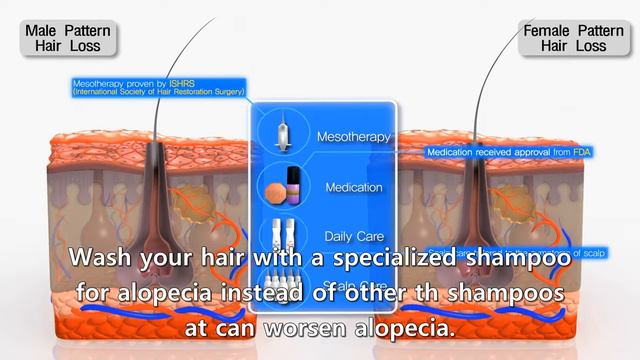 Different Hair Loss causes btw woman and man : narration eng 2018 смотреть онлайн