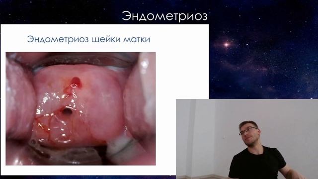 Как делают аборты смотреть онлайн