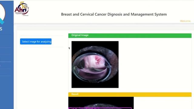 Cervix type classification using Yolo object detection algorithm | Django framework | Demo смотреть онлайн