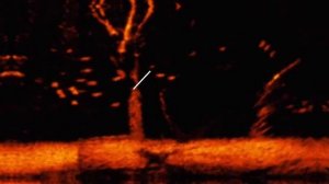 Эхолот транцевый переднего обзора Garmin Panoptix LiveScope