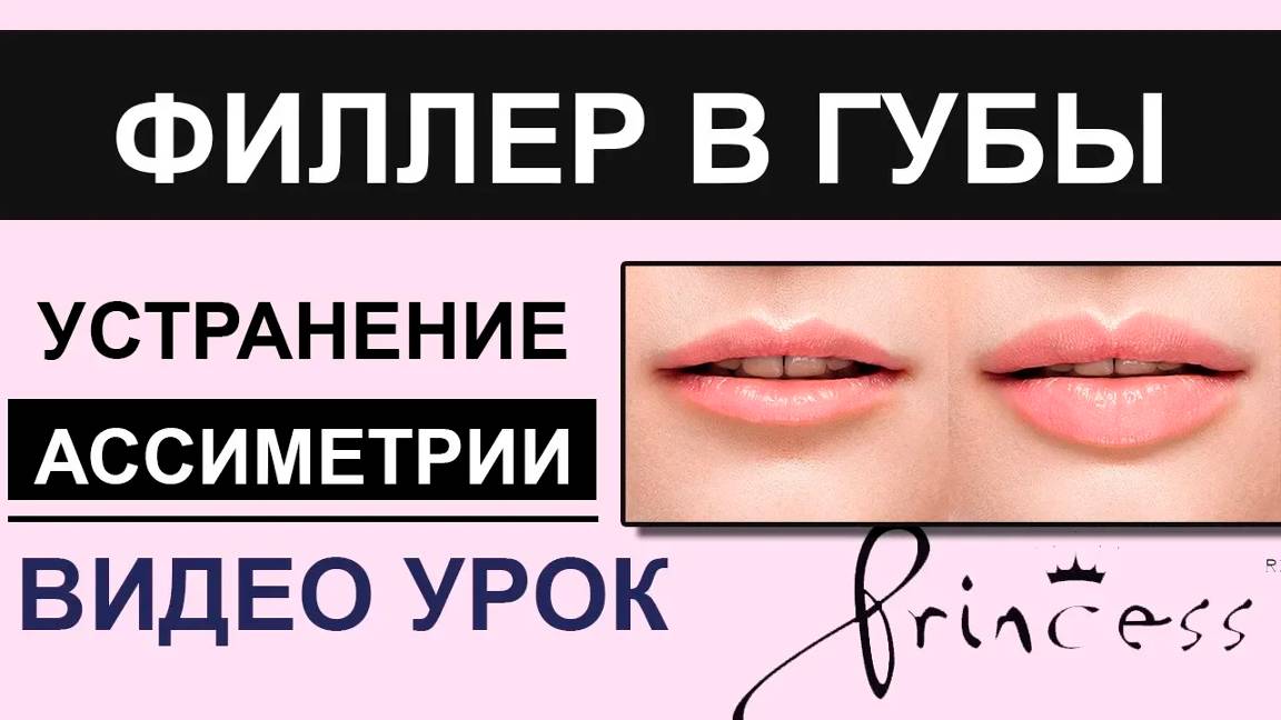 Коррекция формы губ - асимметрия, увеличение смотреть онлайн