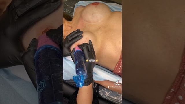 Paramedical tattoos for breast cancer survivors #shorts #breastcancerawareness #breastcancer #ink смотреть онлайн