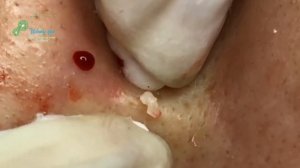 Satisfying Relaxing with Best Video 2021 Windy Spa #027