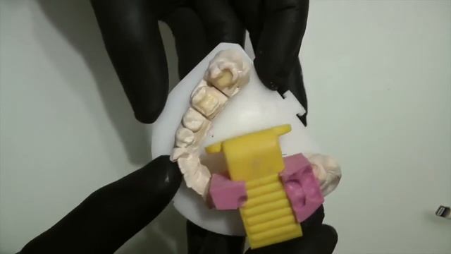 custom xray shield:3 steps смотреть онлайн