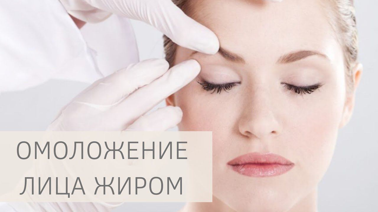 ЛИПОФИЛИНГ ЛИЦА | Омоложение ЖИРОМ смотреть онлайн