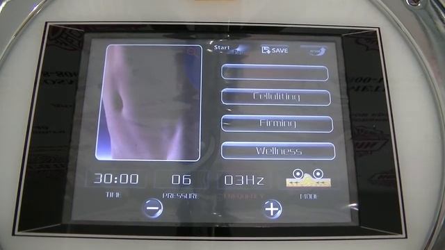 Видеообзор аппарата для вакуумно-роликового массажа Body Optimizer IB-1005 смотреть онлайн