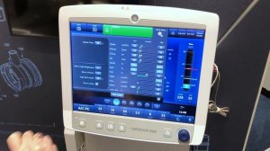 CARESCAPE R860 Ventilator: Alarm Management