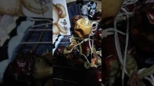 5 день Горло и натрия тиосульфат,