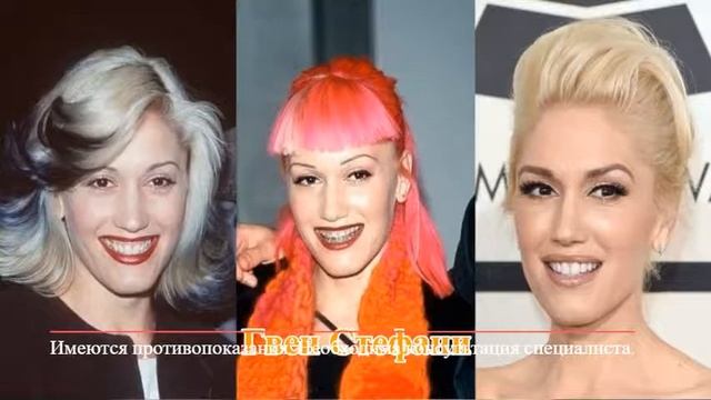 Цены на брекеты и элайнеры в Санкт-Петербурге 2018 смотреть онлайн