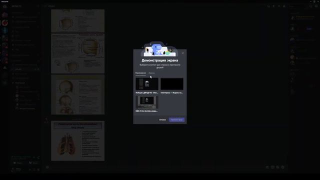 Скелет головы(Свод) смотреть онлайн