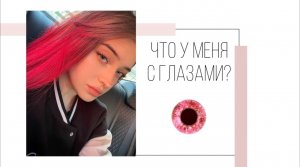 Что у меня с глазами?? \ Как я познакомилась с Гуфи