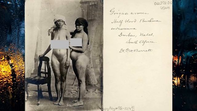 Большие попы, болезнь стеатопигия смотреть онлайн