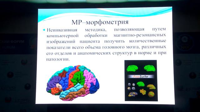 Артемов М.В. - Применение МРТ в психиатрии