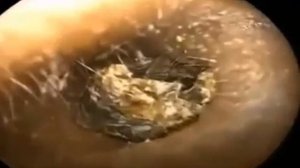 Огромная серная пробка.