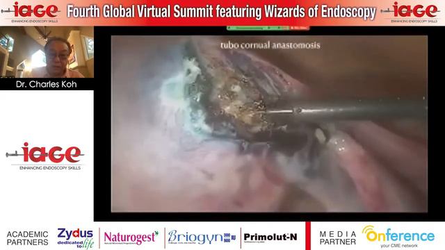 8 Dr Charles Koh IAGE Webinar 21 June 2020 смотреть онлайн