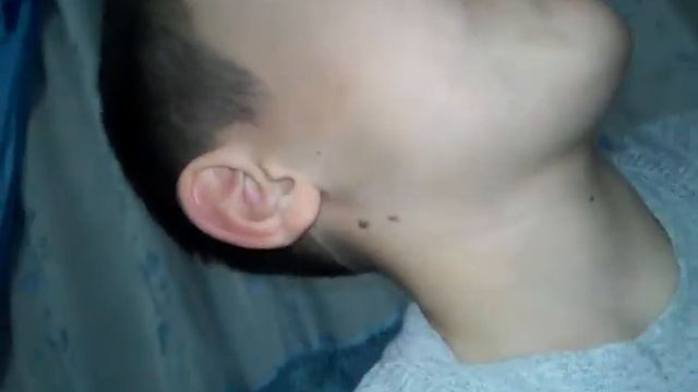 Что будет если добавить аскорбиновою кислоту в жевачку смотреть онлайн