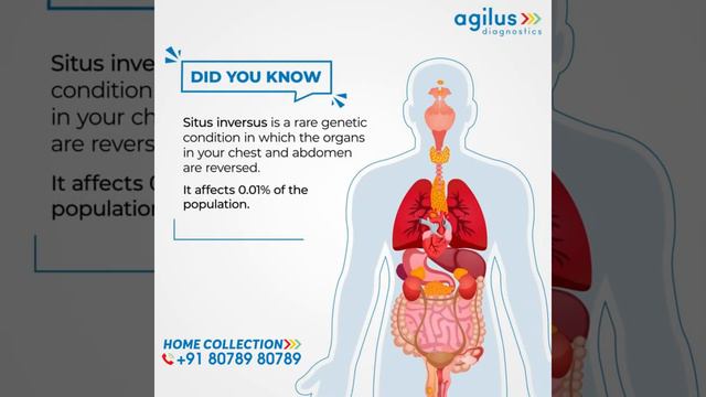 agilus lab best lab #agilus diagnostics смотреть онлайн
