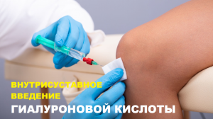 Лечение АРТРОЗА коленного сустава ГИАЛУРОНОВОЙ КИСЛОТОЙ