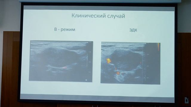 Костромина Е.В. — Место мультипараметрического УЗИ внеорганных образований мягких тканей шеи смотреть онлайн