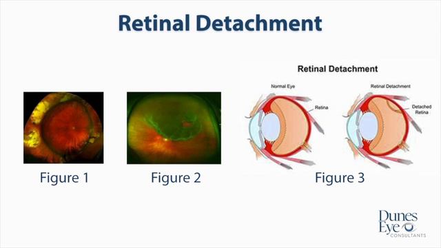 Myopia Management For Your Child