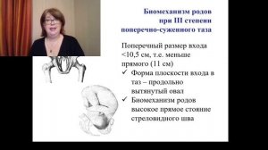 Узкий таз.mp4