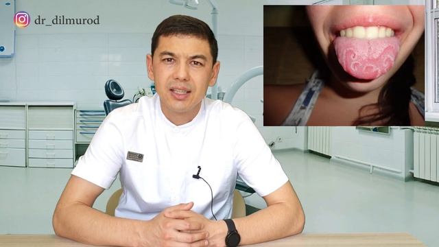 TILDAGI KARASHLAR NIMANI ANGLATADI? ALBATTA KURING/ ТИЛДАГИ КАРАШЛАР