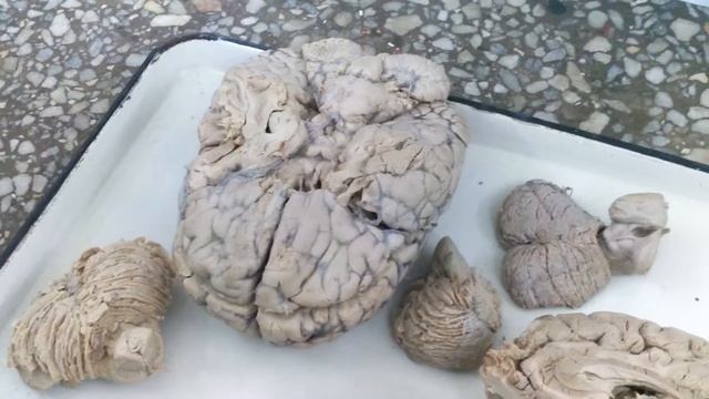 Средний, промежуточный мозг. 3 желудочек. смотреть онлайн