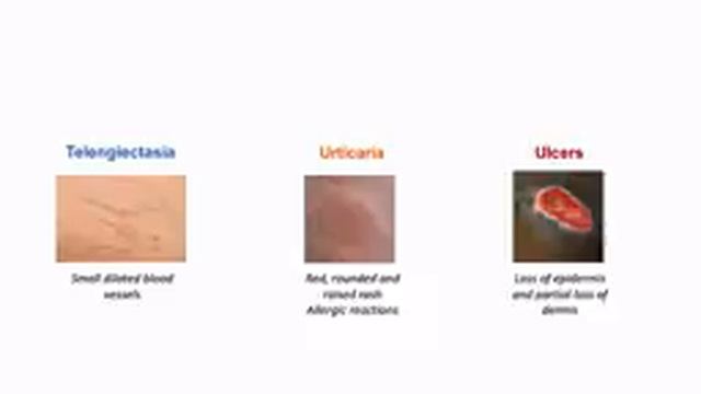 Introduction to Dermatology | The Basics | Describing Skin Lesions (Primary & Secondary Morphology) смотреть онлайн