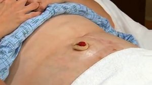 Уход за колостомой (на русском языке)